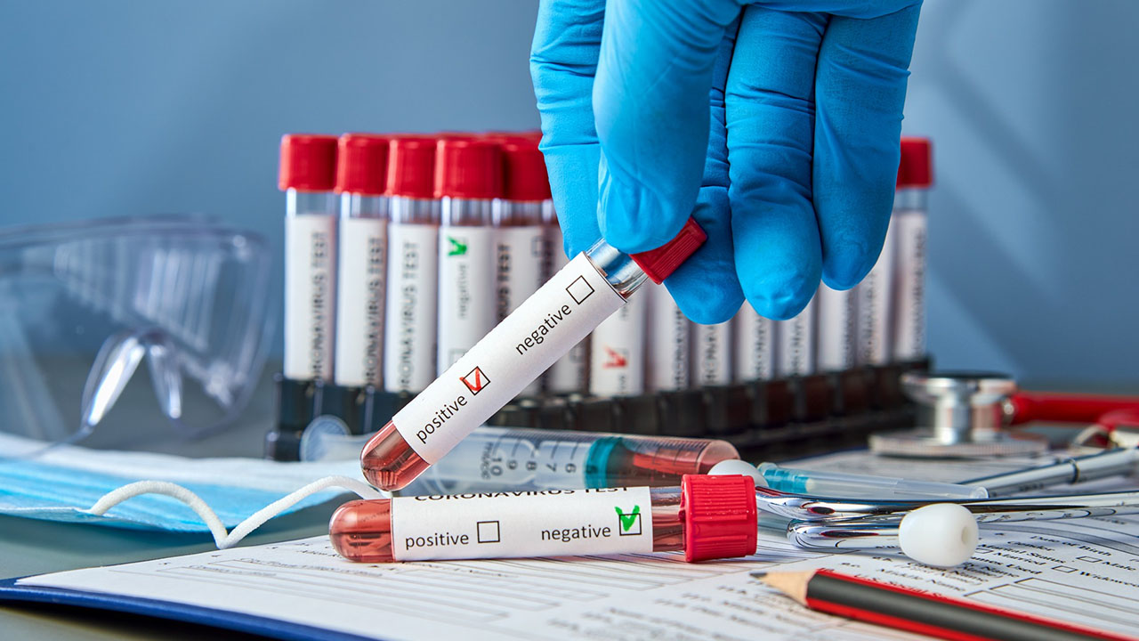 Specific IgE Blood Tests