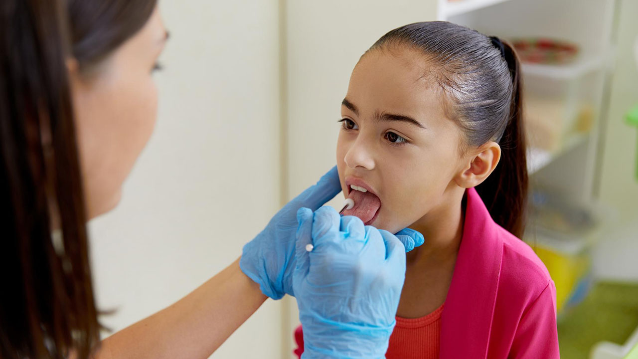 Sublingual Immunotherapy